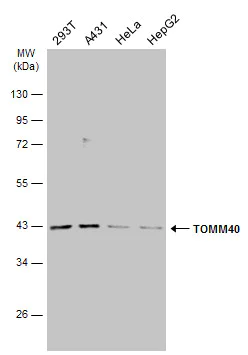 Western blot - Anti-TOMM40 antibody (AB272921)