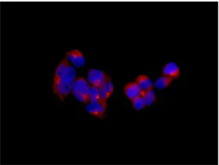 Immunocytochemistry/ Immunofluorescence - Anti-TOMM40 antibody [EPR6932(2)] - BSA and Azide free (AB240964)