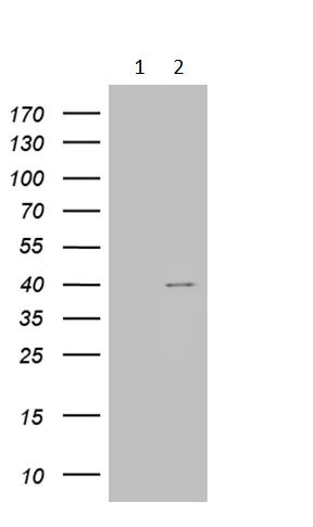 Western blot - Anti-TOMM40L antibody [OTI6F3] (AB236421)