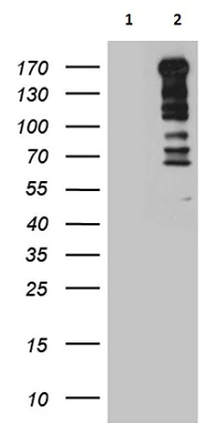 Western blot - Anti-TOPBP 1 antibody [OTI5C12] (AB236523)