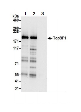Immunoprecipitation - Anti-TopBP1 antibody (AB2402)