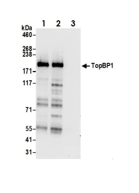 Immunoprecipitation - Anti-TopBP1 antibody (AB2402)