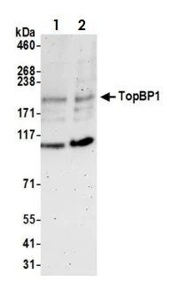 Western blot - Anti-TopBP1 antibody (AB2402)