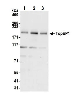 Western blot - Anti-TopBP1 antibody (AB2402)