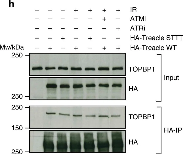 Western blot - Anti-TopBP1 antibody (AB2402)