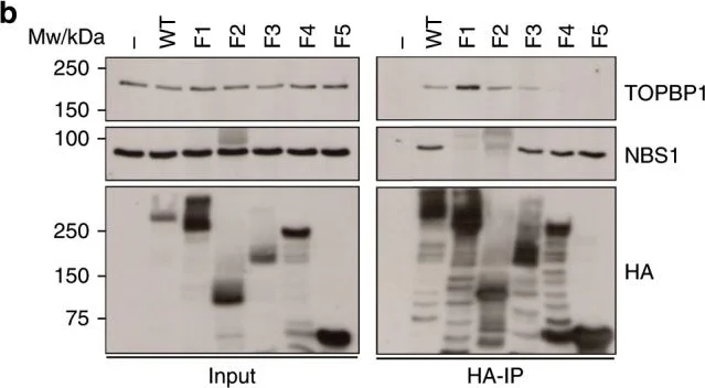 Western blot - Anti-TopBP1 antibody (AB2402)