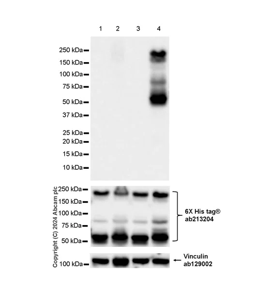 Western blot - Anti-TopBP1 (phospho S1138) antibody [EPR27056-2] (AB316746)