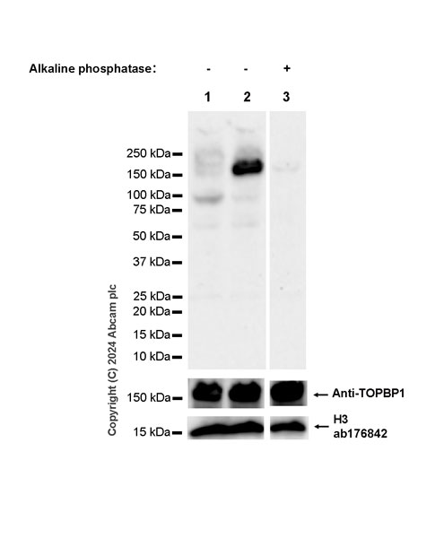 Western blot - Anti-TopBP1 (phospho S1138) antibody [EPR27056-2] - BSA and Azide free (AB316747), expandable thumbnail