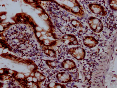 Immunohistochemistry (Formalin/PFA-fixed paraffin-embedded sections) - Anti-Topoisomerase I antibody [6D8] (AB314011)