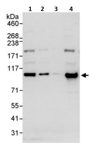 Western blot - Anti-Topoisomerase I antibody (AB245431)