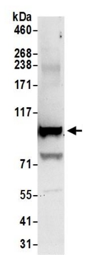 Immunoprecipitation - Anti-Topoisomerase I antibody (AB245432), expandable thumbnail