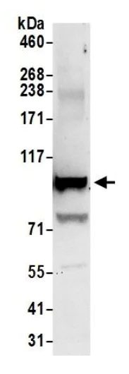 Immunoprecipitation - Anti-Topoisomerase I antibody (AB245432)