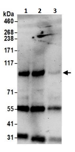 Immunoprecipitation - Anti-Topoisomerase I antibody (AB245432), expandable thumbnail