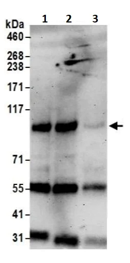 Immunoprecipitation - Anti-Topoisomerase I antibody (AB245432)