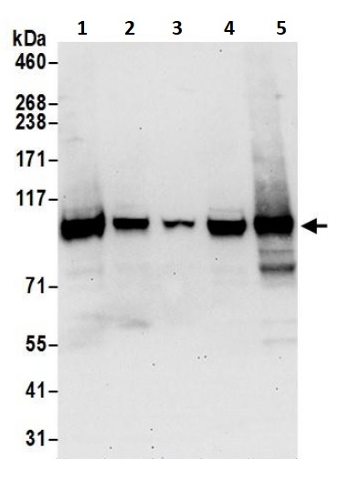 Western blot - Anti-Topoisomerase I antibody (AB245432), expandable thumbnail