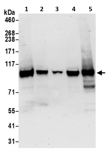 Western blot - Anti-Topoisomerase I antibody (AB245432)