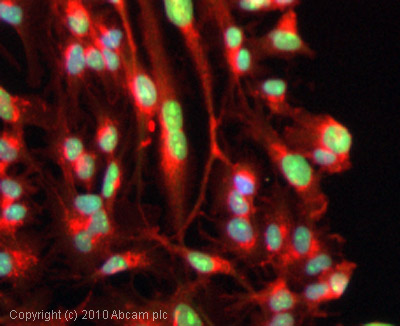 Immunocytochemistry/ Immunofluorescence - Anti-Topoisomerase I antibody (AB28432)