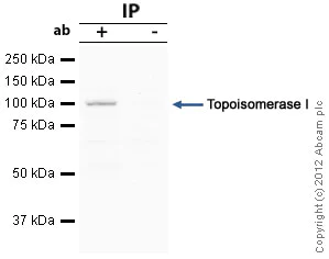 Immunoprecipitation - Anti-Topoisomerase I antibody (AB85038)