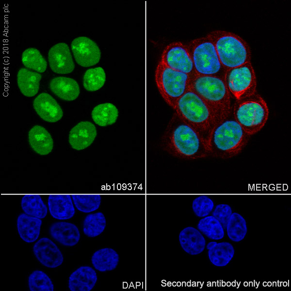 Immunocytochemistry/ Immunofluorescence - Anti-Topoisomerase I antibody [EPR5375] (AB109374), expandable thumbnail