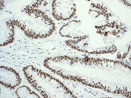 Immunohistochemistry (Formalin/PFA-fixed paraffin-embedded sections) - Anti-Topoisomerase I antibody [EPR5375] (ab109374), expandable thumbnail