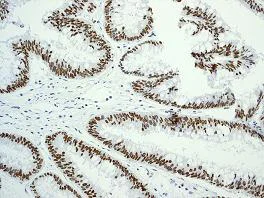 Immunohistochemistry (Formalin/PFA-fixed paraffin-embedded sections) - Anti-Topoisomerase I antibody [EPR5375] (AB109374)