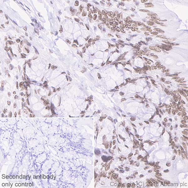 Immunohistochemistry (Formalin/PFA-fixed paraffin-embedded sections) - Anti-Topoisomerase I antibody [EPR5375] (AB109374), expandable thumbnail