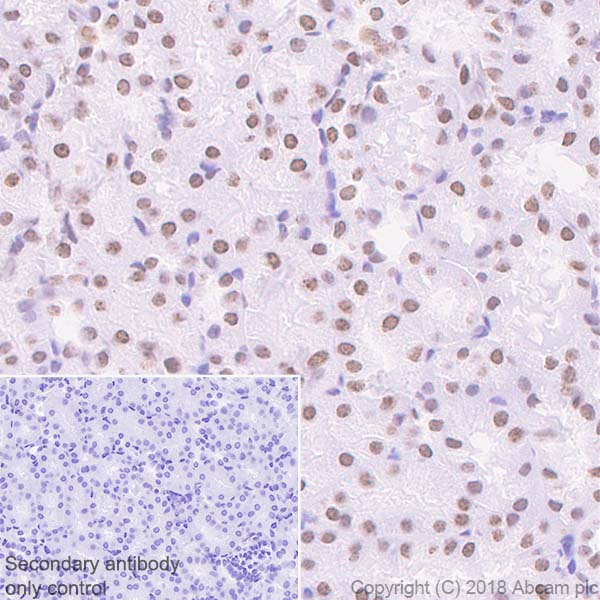 Immunohistochemistry (Formalin/PFA-fixed paraffin-embedded sections) - Anti-Topoisomerase I antibody [EPR5375] (AB109374), expandable thumbnail