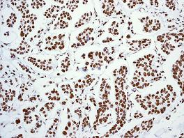 Immunohistochemistry (Formalin/PFA-fixed paraffin-embedded sections) - Anti-Topoisomerase I antibody [EPR5375] (ab109374), expandable thumbnail