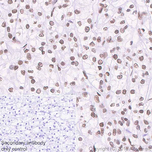 Immunohistochemistry (Formalin/PFA-fixed paraffin-embedded sections) - Anti-Topoisomerase I antibody [EPR5375] - BSA and Azide free (AB219735)