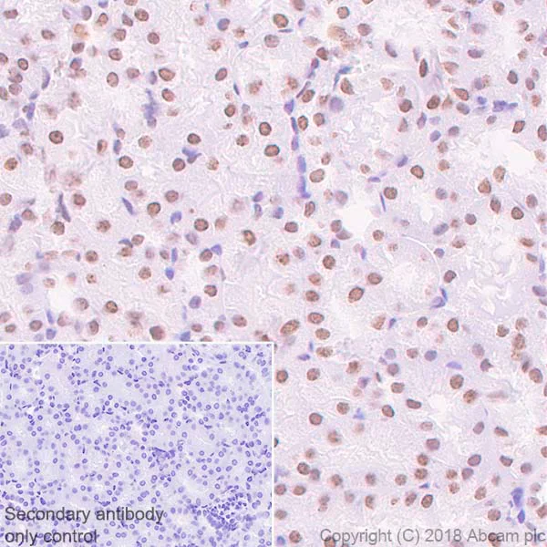 Immunohistochemistry (Formalin/PFA-fixed paraffin-embedded sections) - Anti-Topoisomerase I antibody [EPR5375] - BSA and Azide free (AB219735)
