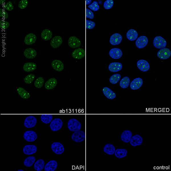 Immunocytochemistry/ Immunofluorescence - Anti-Topoisomerase I antibody [EPR5376(2)] (AB131166), expandable thumbnail