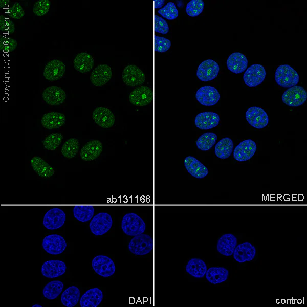 Immunocytochemistry/ Immunofluorescence - Anti-Topoisomerase I antibody [EPR5376(2)] - BSA and Azide free (AB240047)
