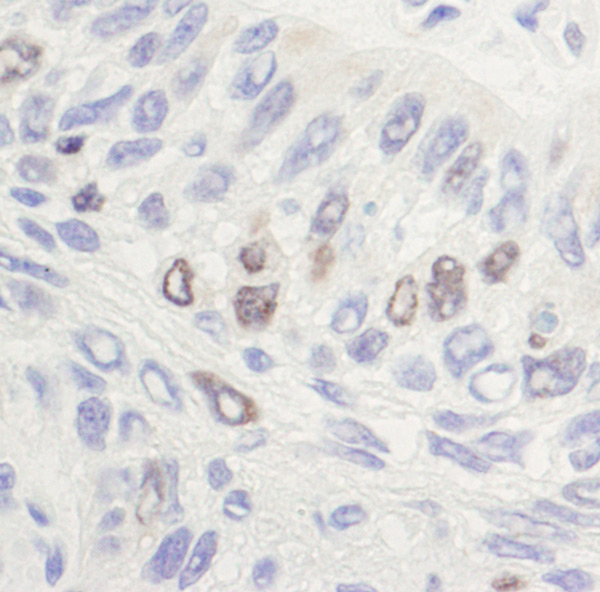 Immunohistochemistry (Formalin/PFA-fixed paraffin-embedded sections) - Anti-Topoisomerase II alpha antibody (AB12318)