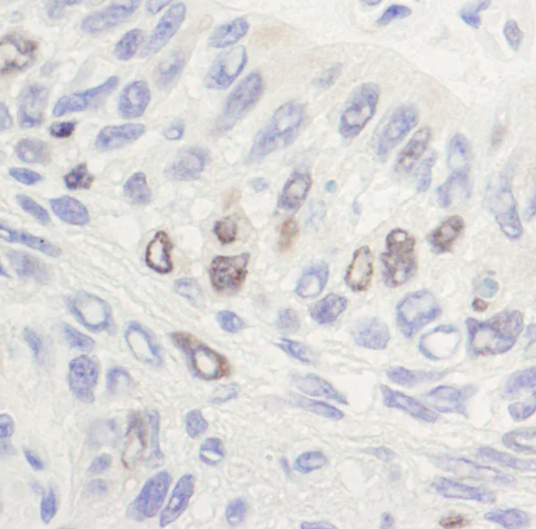 Immunohistochemistry (Formalin/PFA-fixed paraffin-embedded sections) - Anti-Topoisomerase II alpha antibody (AB12318)
