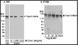 Immunoprecipitation - Anti-Topoisomerase II alpha antibody (AB12318)