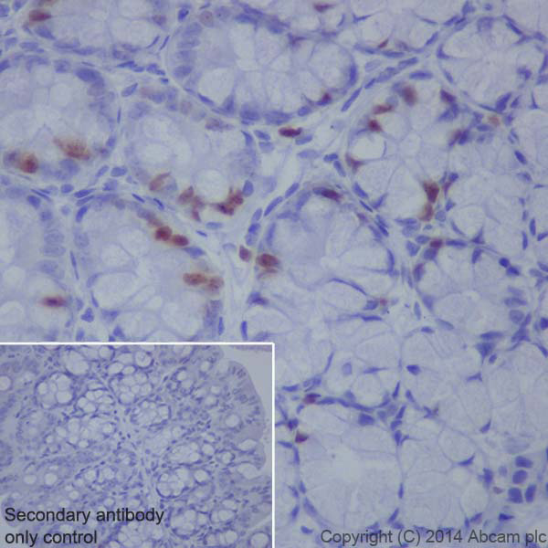 Immunohistochemistry (Formalin/PFA-fixed paraffin-embedded sections) - Anti-Topoisomerase II alpha antibody [EP1102Y] (AB52934), expandable thumbnail
