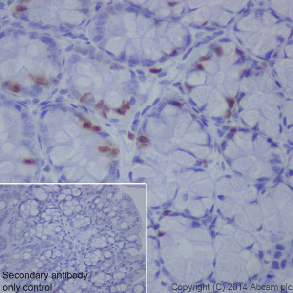 Immunohistochemistry (Formalin/PFA-fixed paraffin-embedded sections) - Anti-Topoisomerase II alpha antibody [EP1102Y] (AB52934)