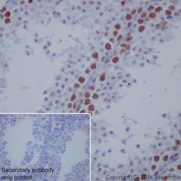 Immunohistochemistry (Formalin/PFA-fixed paraffin-embedded sections) - Anti-Topoisomerase II alpha antibody [EP1102Y] (ab52934), expandable thumbnail