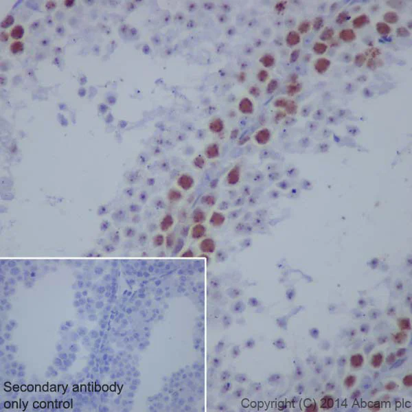 Immunohistochemistry (Formalin/PFA-fixed paraffin-embedded sections) - Anti-Topoisomerase II alpha antibody [EP1102Y] (AB52934)