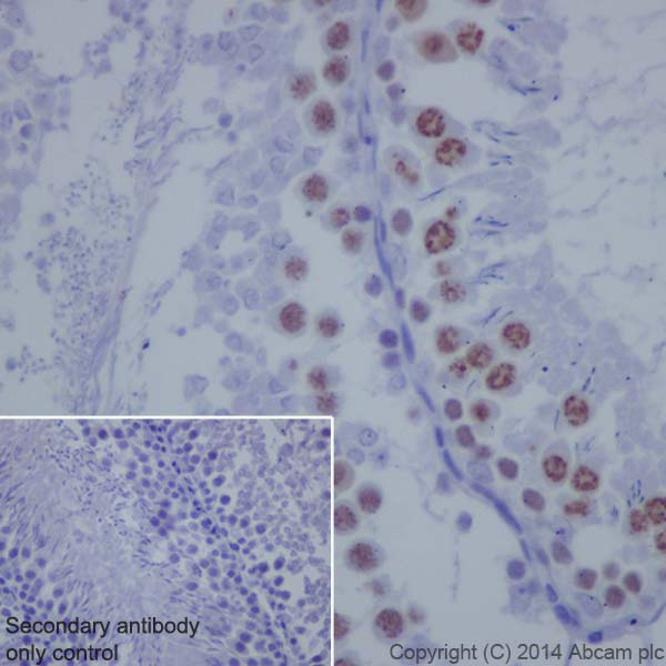 Immunohistochemistry (Formalin/PFA-fixed paraffin-embedded sections) - Anti-Topoisomerase II alpha antibody [EP1102Y] (AB52934), expandable thumbnail
