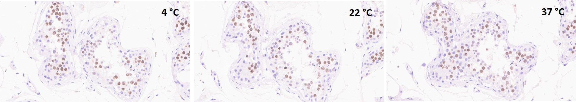 Immunohistochemistry (Formalin/PFA-fixed paraffin-embedded sections) - Anti-Topoisomerase II alpha antibody [EP1102Y] (AB52934)