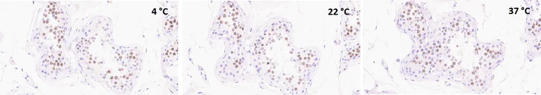 Immunohistochemistry (Formalin/PFA-fixed paraffin-embedded sections) - Anti-Topoisomerase II alpha antibody [EP1102Y] (AB52934)