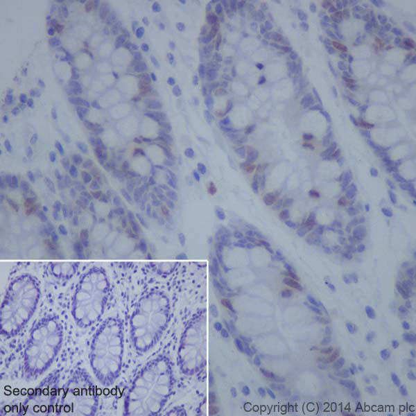 Immunohistochemistry (Formalin/PFA-fixed paraffin-embedded sections) - Anti-Topoisomerase II alpha antibody [EP1102Y] (ab52934), expandable thumbnail