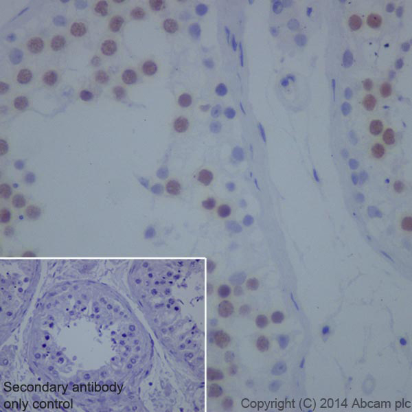 Immunohistochemistry (Formalin/PFA-fixed paraffin-embedded sections) - Anti-Topoisomerase II alpha antibody [EP1102Y] (ab52934), expandable thumbnail