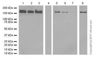 Western blot - Anti-Topoisomerase II alpha antibody [EP1102Y] (AB52934), expandable thumbnail