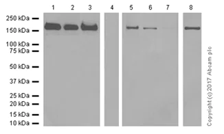 Anti-Topoisomerase II alpha antibody [EP1102Y] (ab52934) | Abcam