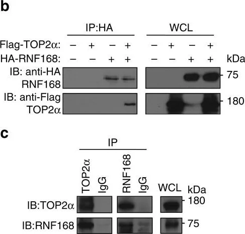 Western blot - Anti-Topoisomerase II alpha antibody [EP1102Y] (AB52934)