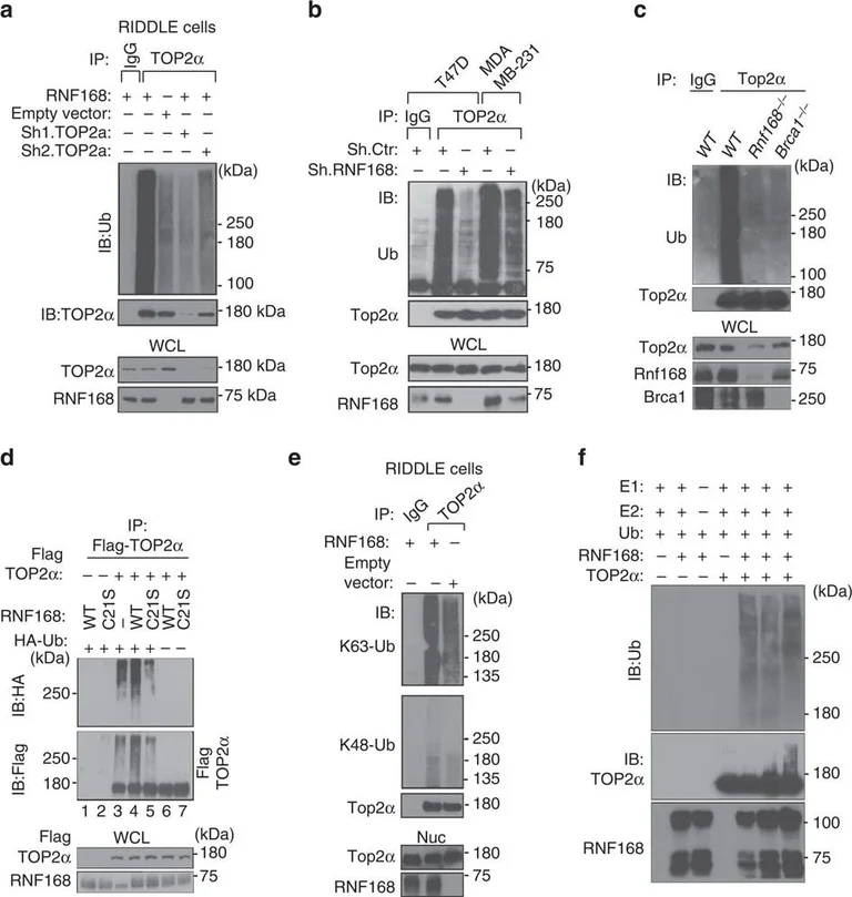Western blot - Anti-Topoisomerase II alpha antibody [EP1102Y] (AB52934)