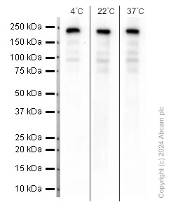 Western blot - Anti-Topoisomerase II alpha antibody [EP1102Y] (AB52934)