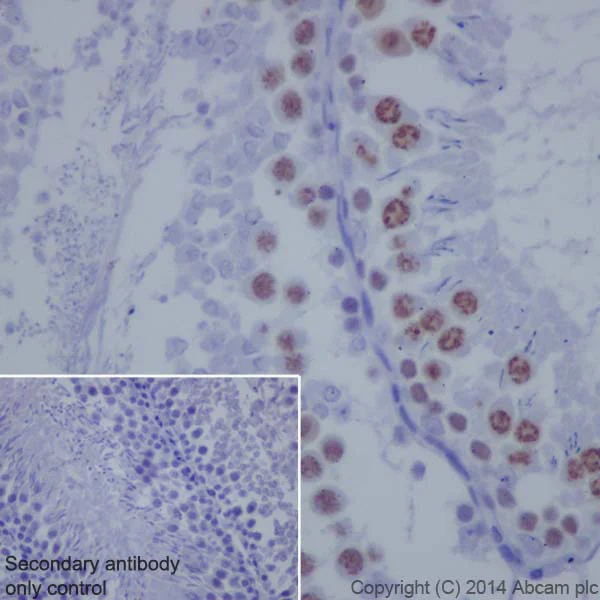 Immunohistochemistry (Formalin/PFA-fixed paraffin-embedded sections) - Anti-Topoisomerase II alpha antibody [EP1102Y] - BSA and Azide free (AB181828)